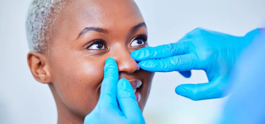 Rhinoplasty Turkey Cost What You Should Know
