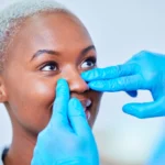 Rhinoplasty Turkey Cost What You Should Know